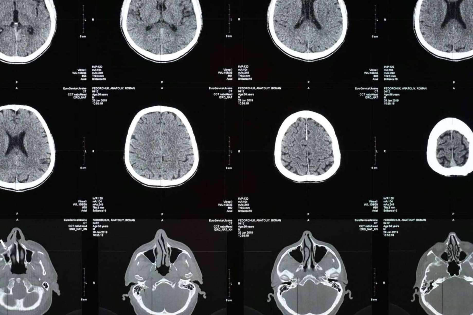 New screening tool to detect childhood mental disorders